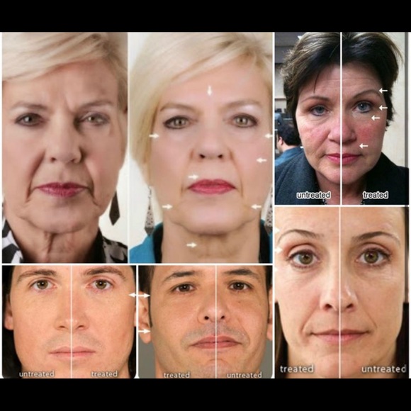 [NIB] Nuskin facial spa + conductive gel - Picture 4 of 9